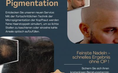 Action: Scalp Micro Pigmentation