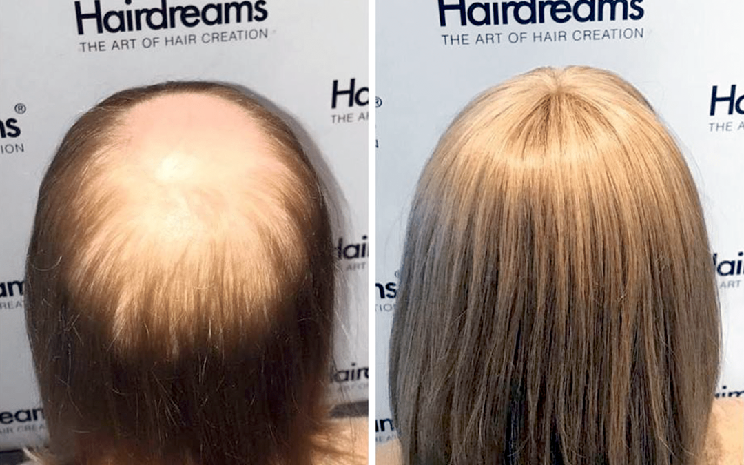 Hairdreams Microlines